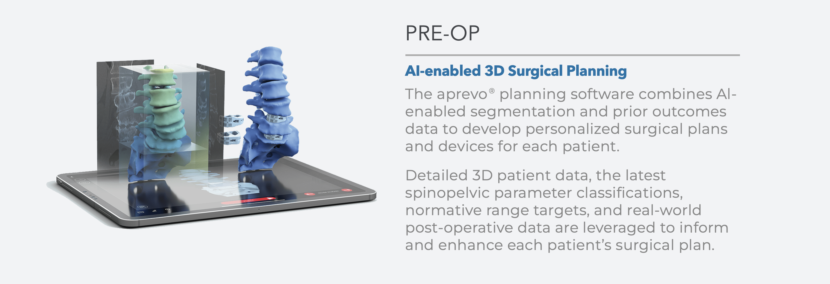 Pre-op aprevo AI-enabled 3D surgical planning shown on a tablet, with a 3D spine model and personalized interbody devices.