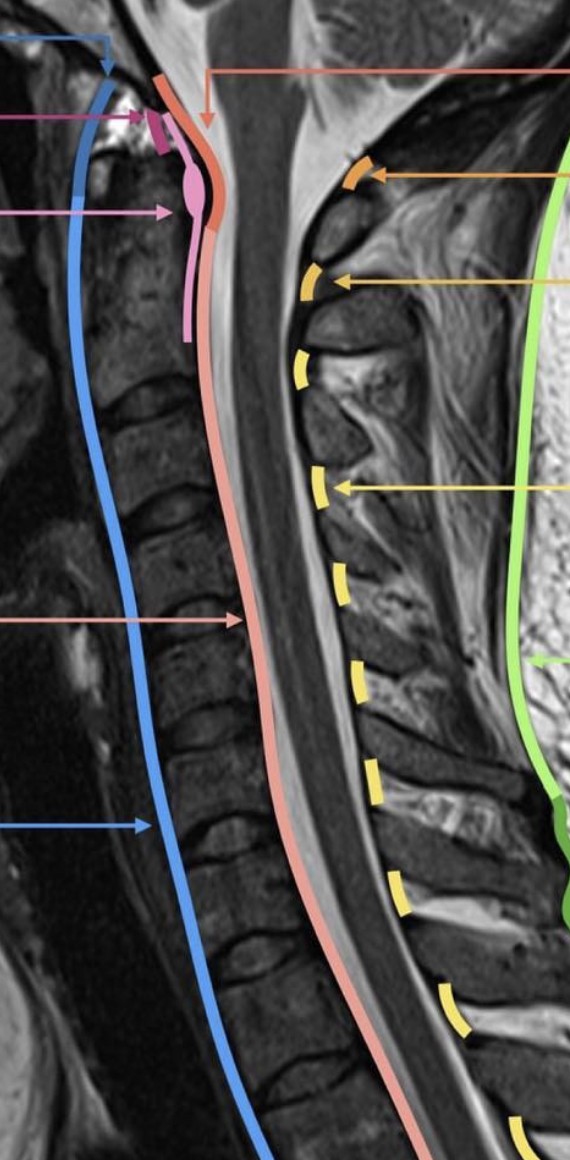 Interactive annotated sagittal MRI of the cervical (neck) spine