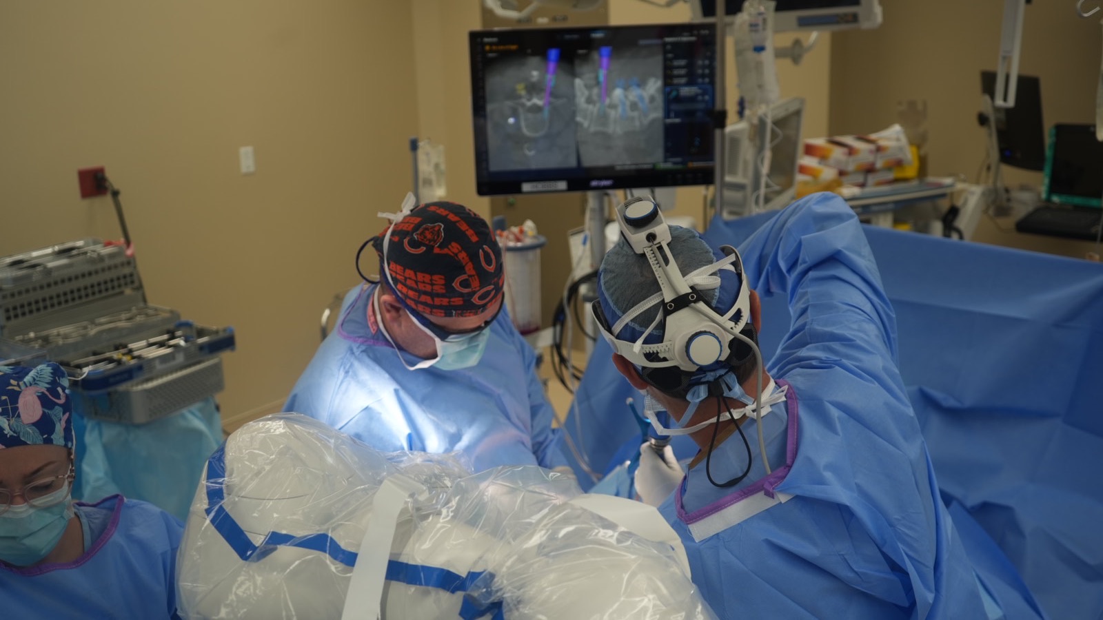 Surgical team at the operating table with planned implant trajectories displayed on the navigation screen