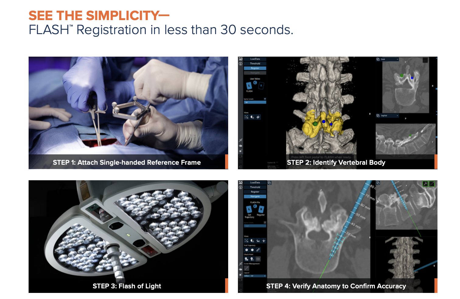 The four steps of 7D FLASH registration: attach the reference frame, identify the vertebral body, flash of light, and verify the anatomy to confirm accuracy